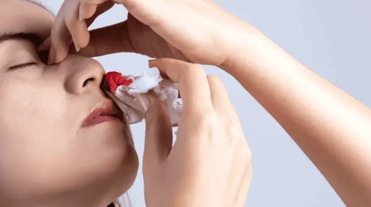 Ola de Calor en México: ¿Por qué sale sangre de la nariz durante las altas temperaturas?