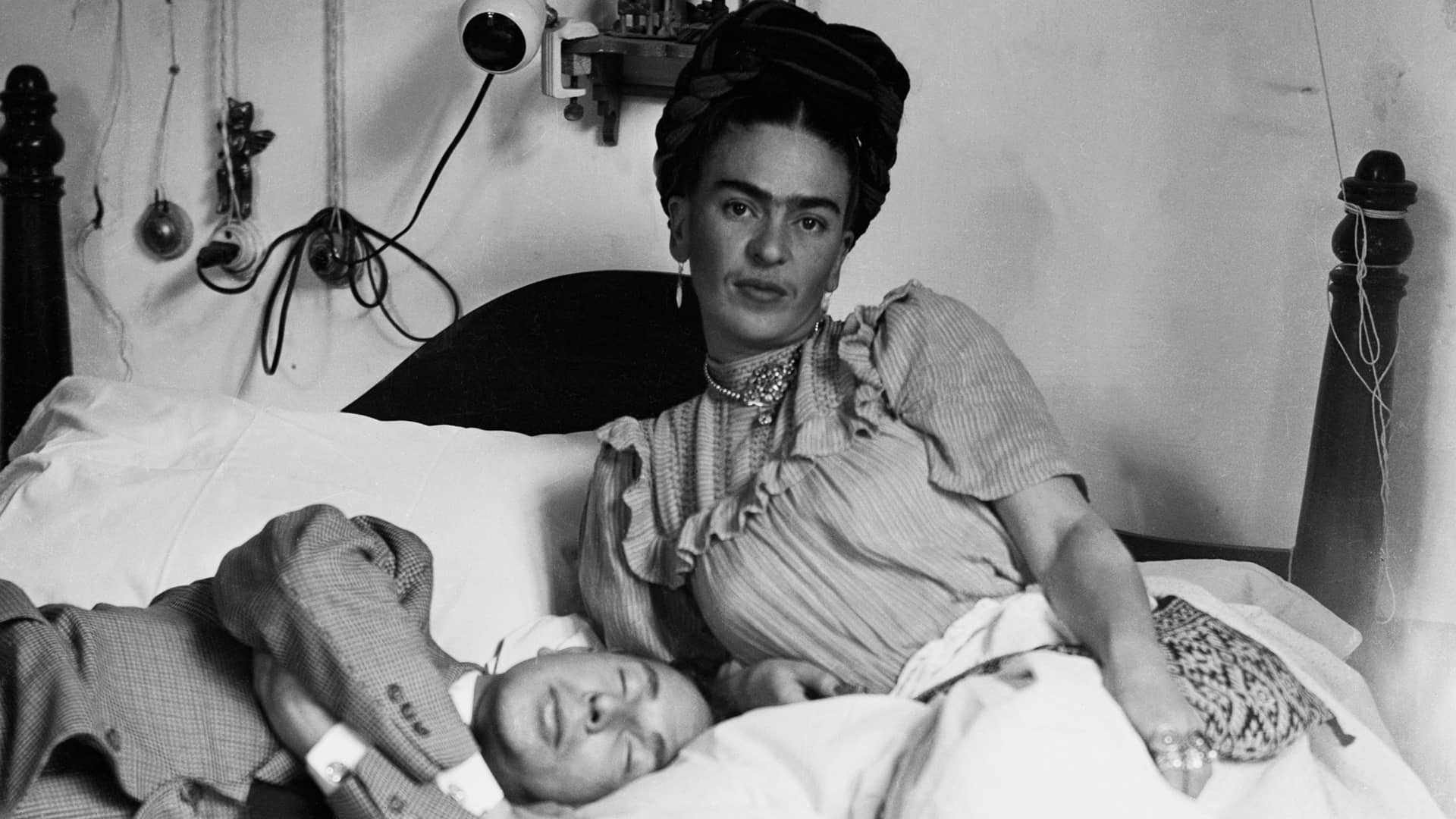 Diagnostican a Frida Kahlo 70 años después: síndrome de cola de caballo