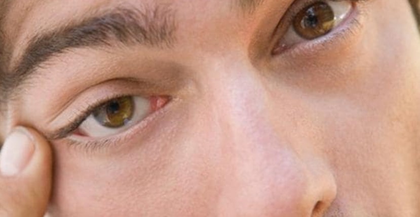 Por qué tiembla el párpado y qué implica para la salud