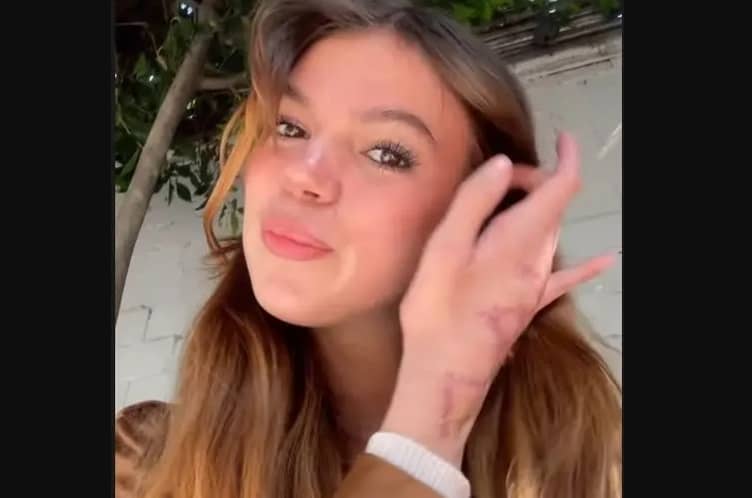 Valentina Gilabert muestra las cicatrices que le dejó el brutal ataque de Marianne Gonzaga