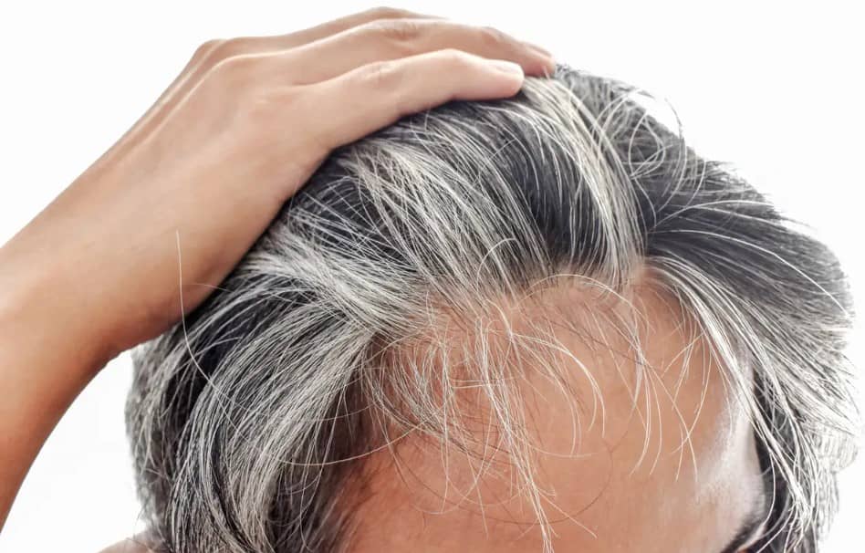Las canas son un problema al que muchas personas lo temen, te decimos por qué aparecen y cómo puedes evitarlas.