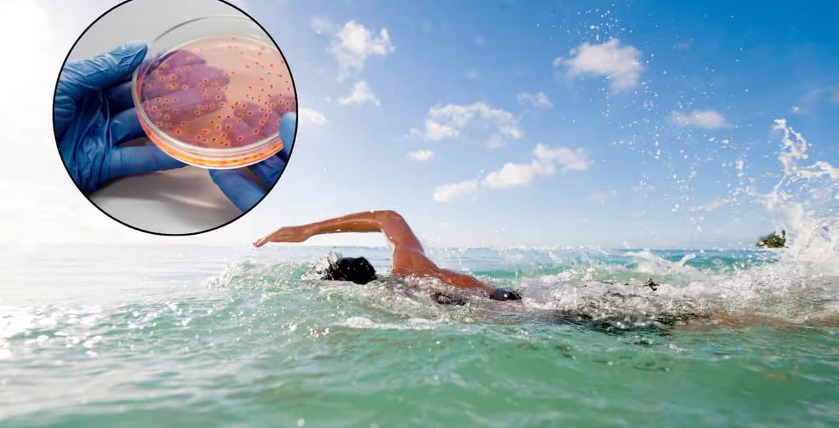 Suman cuatro muertos por una bacteria carnívora en Florida