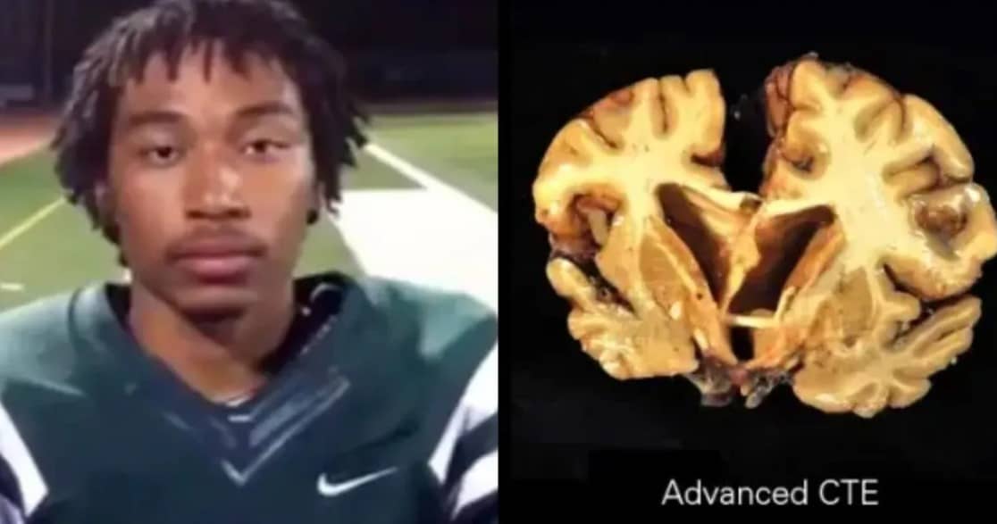 Encefalopatía traumática crónica (ETC), la enfermedad que aseguró sufrir el tirador de Nueva York