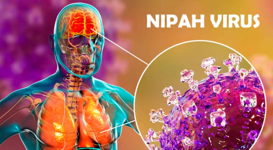 Alerta por virus Nipah: síntomas y cómo se contagia la enfermedad con alta tasa de mortalidad