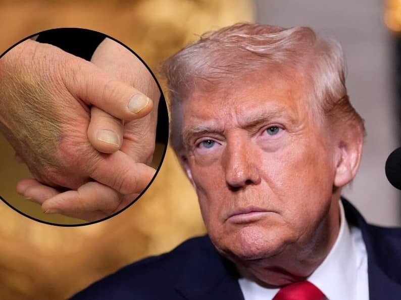 Trump insiste en que posee una “perfecta salud” y excelentes resultados cognitivos