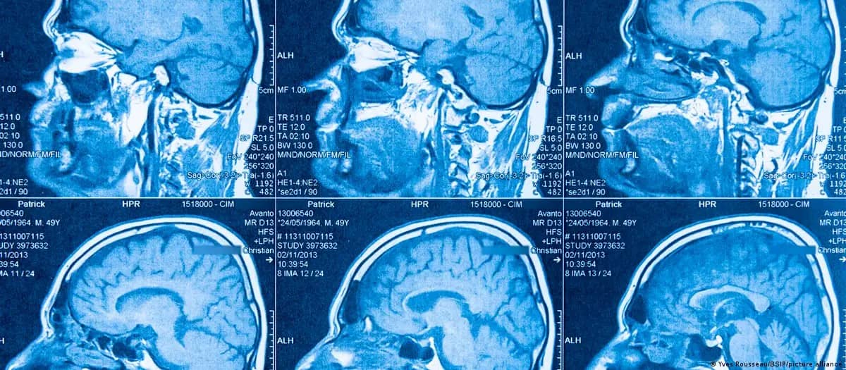 El cerebro humano no es uno, sino dos órganos